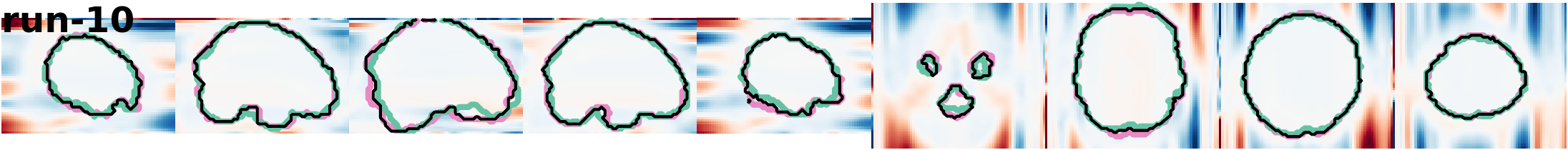 slices_run-10