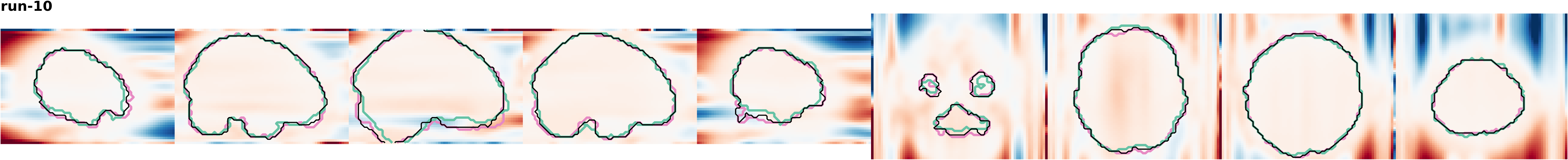 slices_run-10