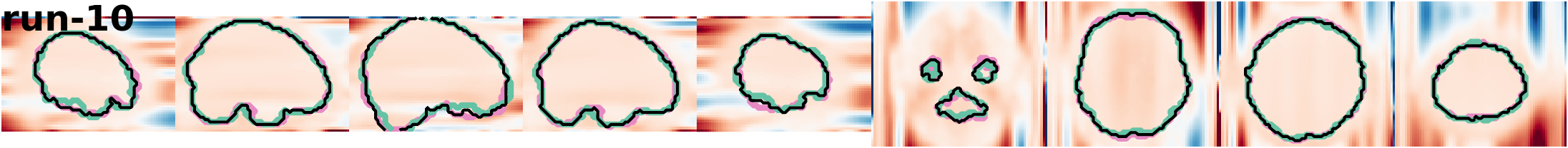 slices_run-10