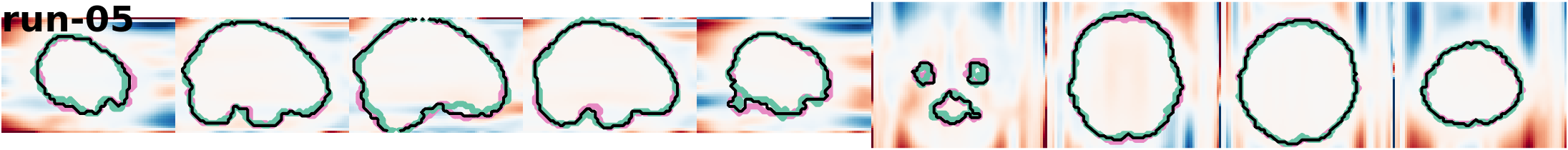 slices_run-05
