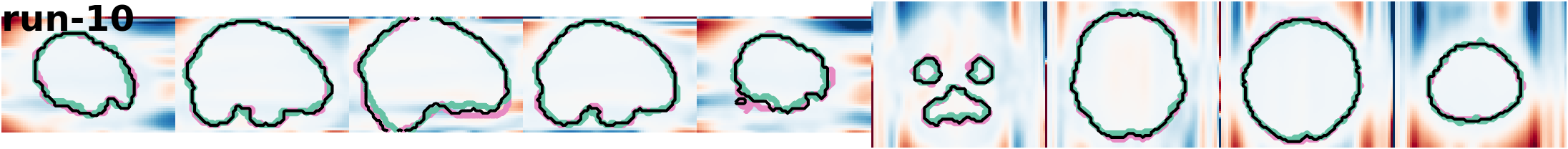 slices_run-10