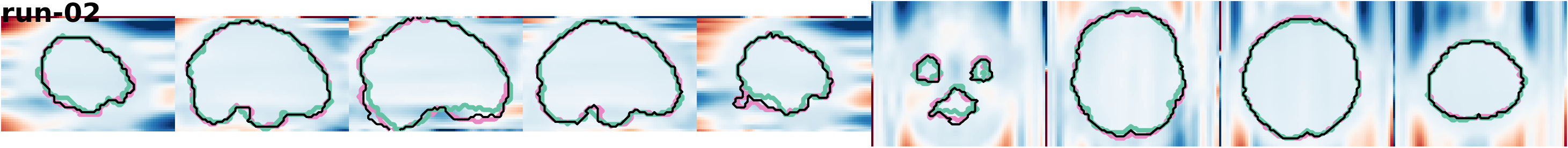 slices_run-02