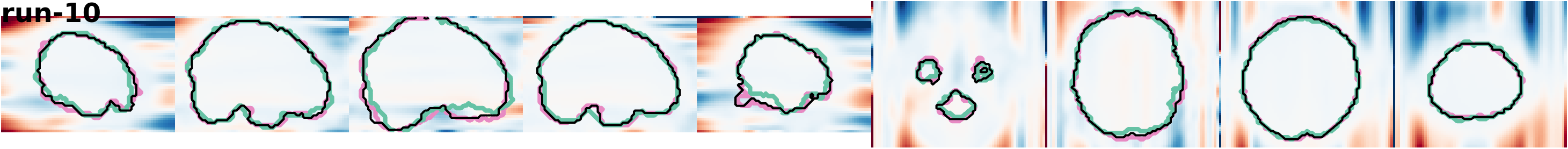 slices_run-10