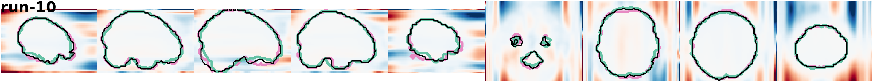 slices_run-10