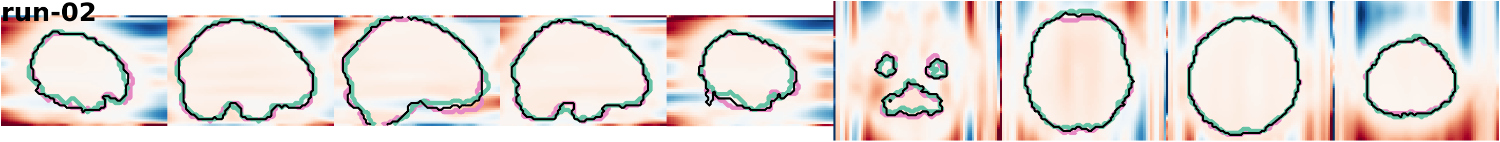 slices_run-02
