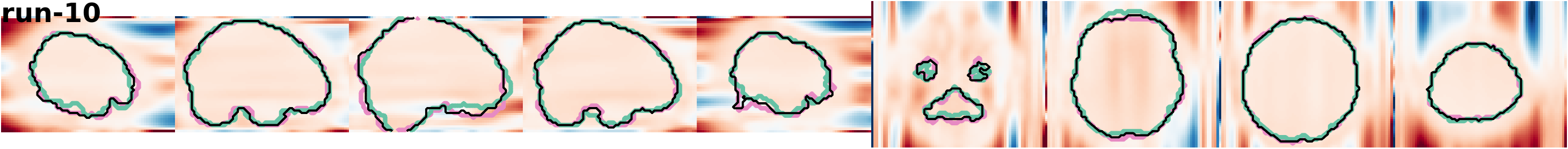 slices_run-10
