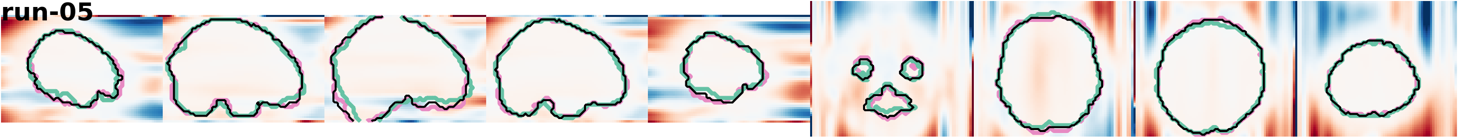 slices_run-05