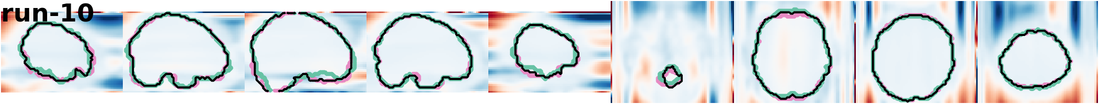 slices_run-10