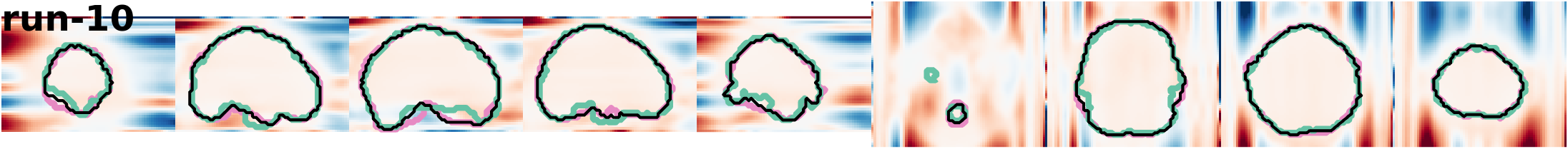 slices_run-10