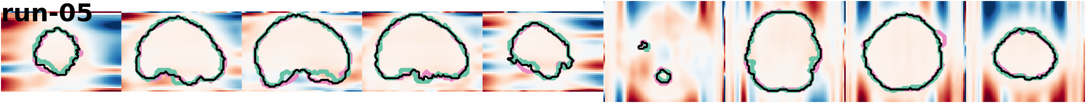 slices_run-05