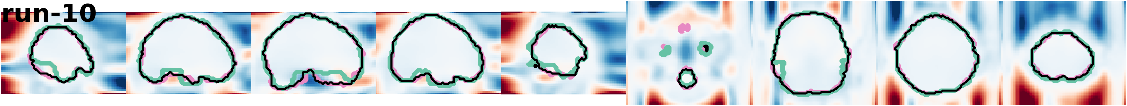slices_run-10