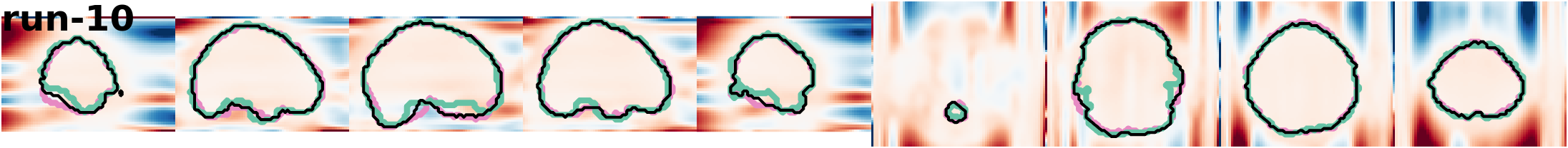 slices_run-10