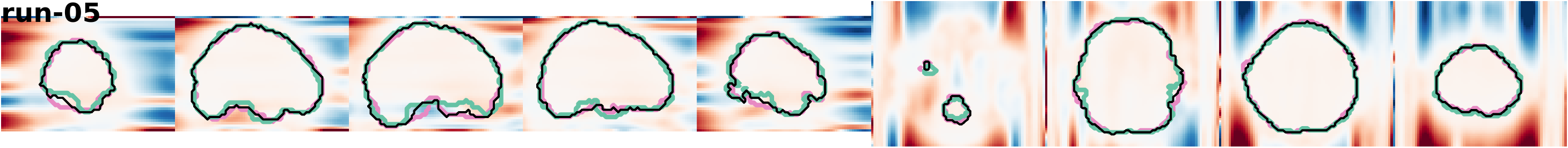 slices_run-05