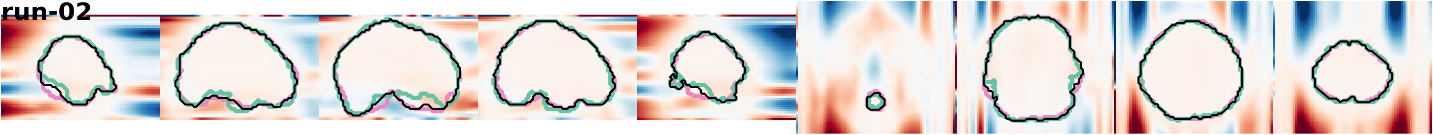 slices_run-02