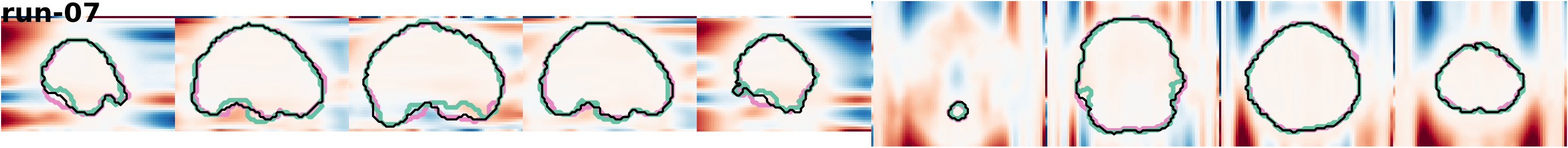 slices_run-07