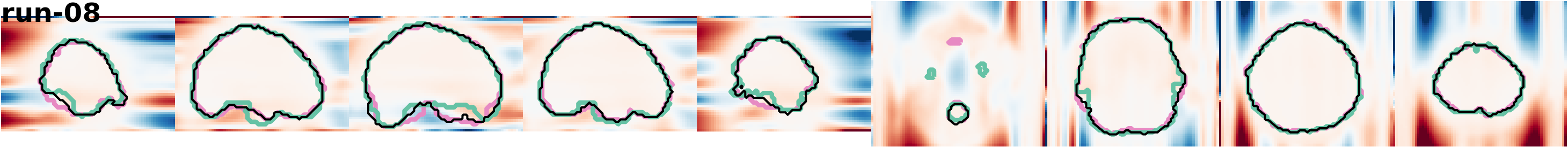 slices_run-08