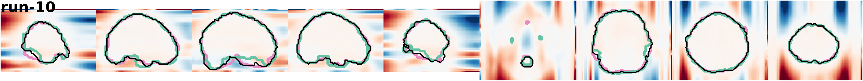 slices_run-10