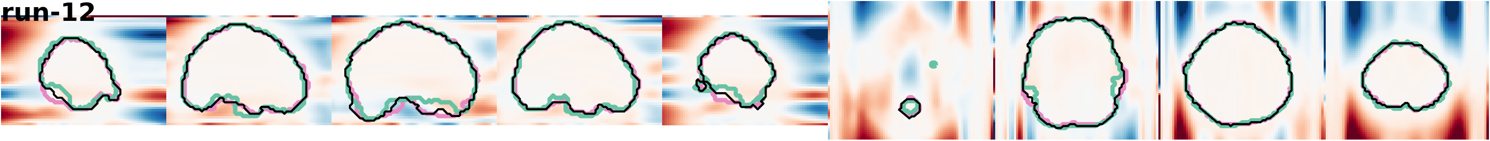 slices_run-12