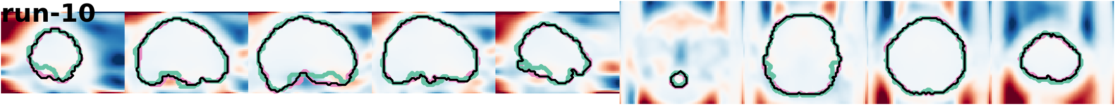 slices_run-10