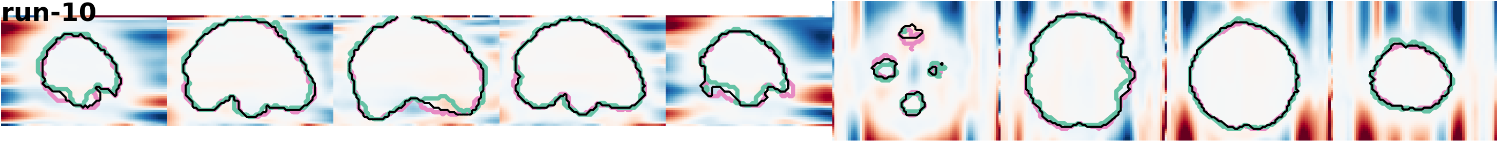 slices_run-10