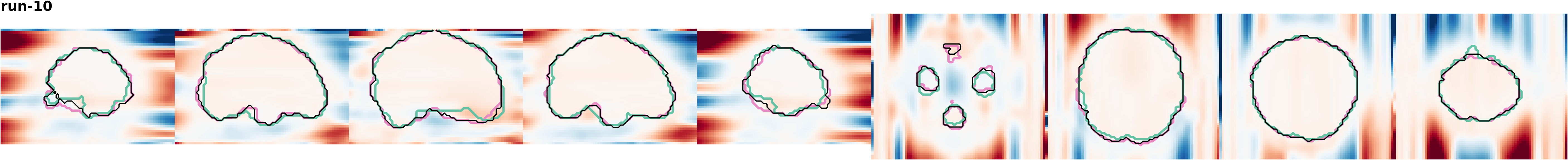 slices_run-10
