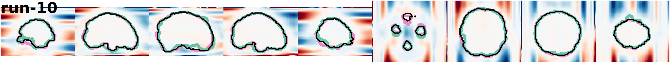 slices_run-10