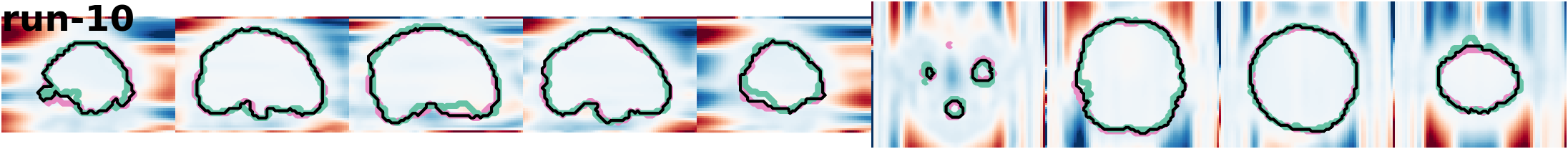slices_run-10