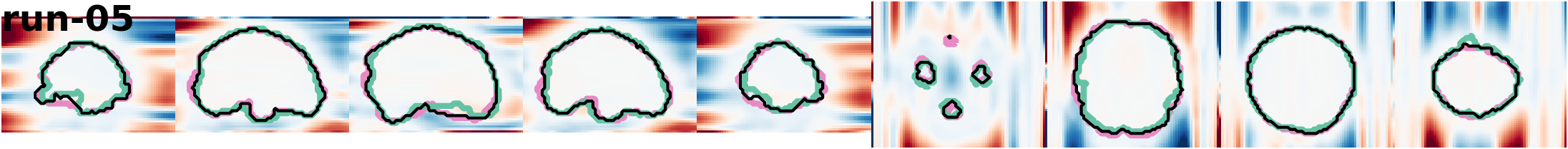 slices_run-05