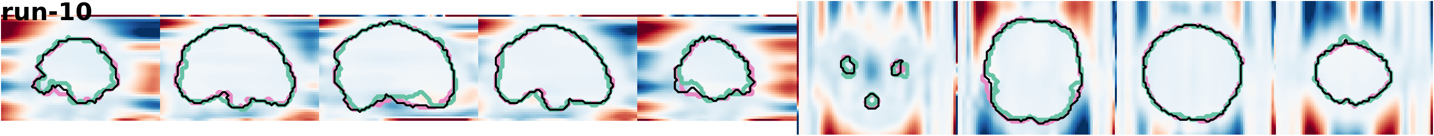 slices_run-10