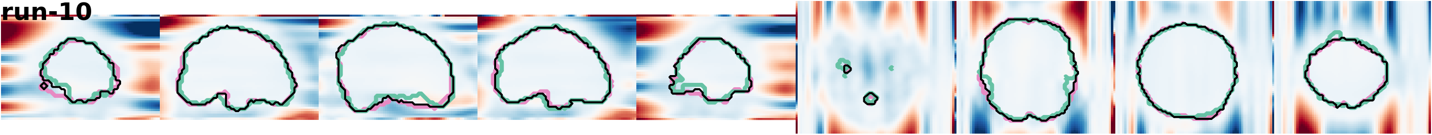 slices_run-10