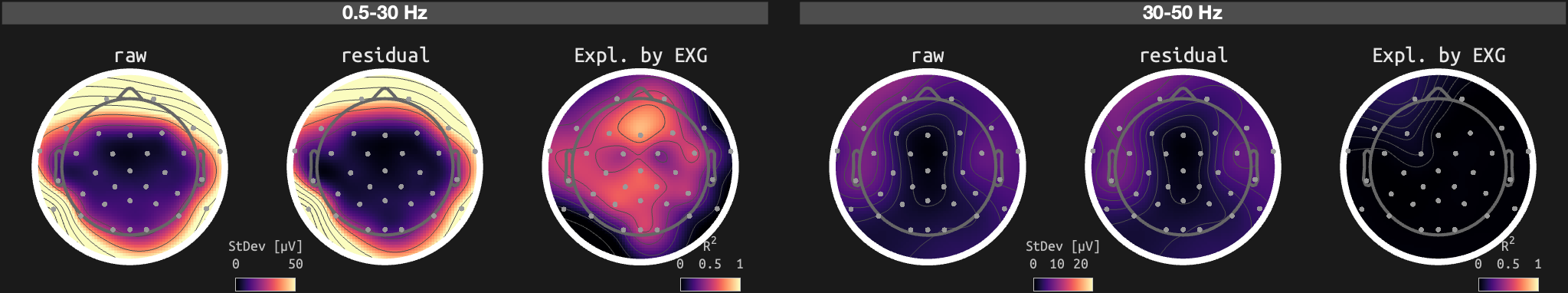 figs/sub-01_ses-15_run-01.png