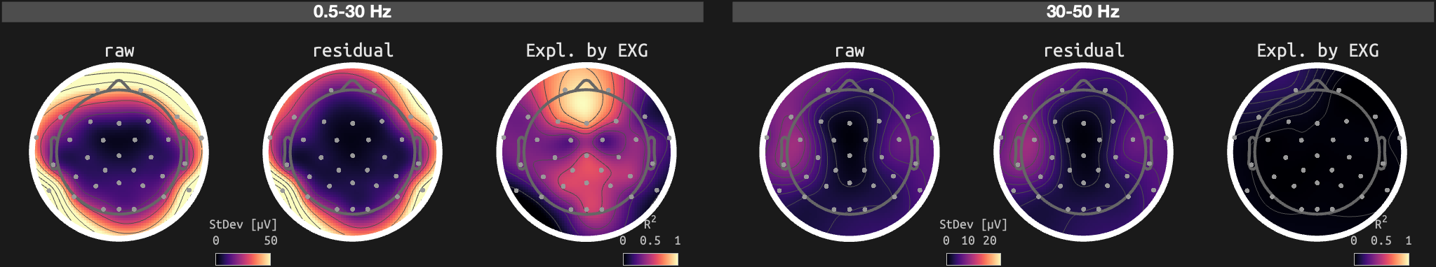 figs/sub-01_ses-15_run-02.png