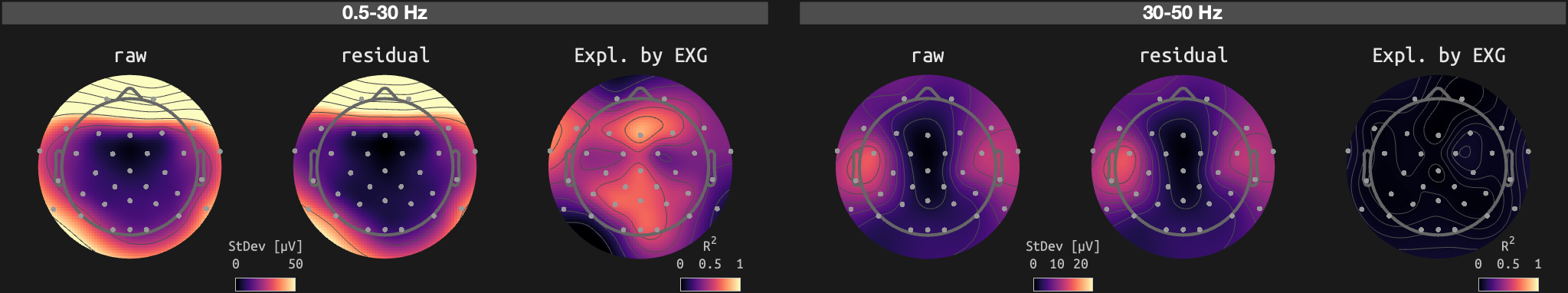 figs/sub-01_ses-15_run-05.png