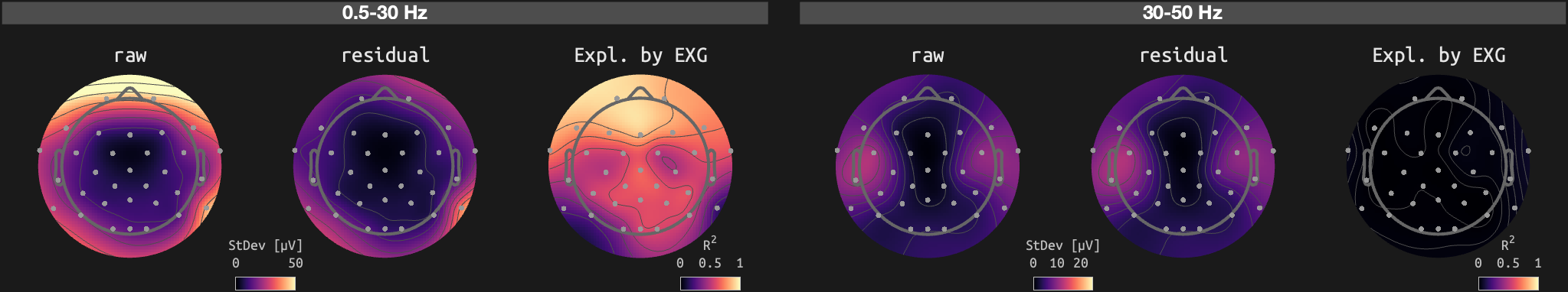figs/sub-01_ses-15_run-06.png