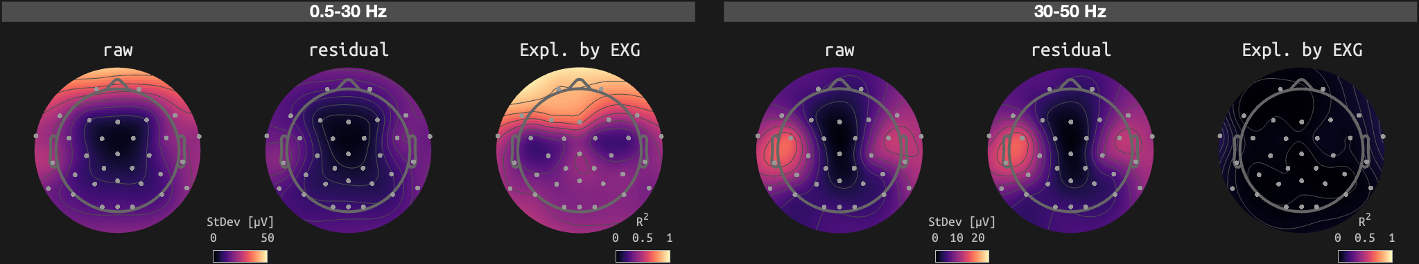 figs/sub-01_ses-15_run-10.png