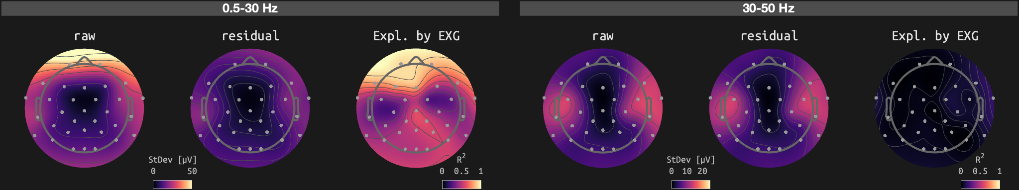 figs/sub-01_ses-15_run-11.png