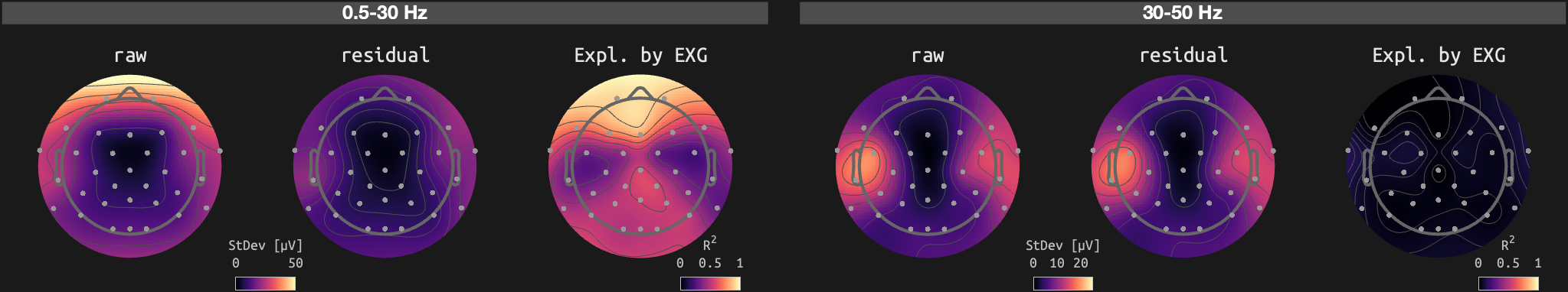 figs/sub-01_ses-15_run-12.png