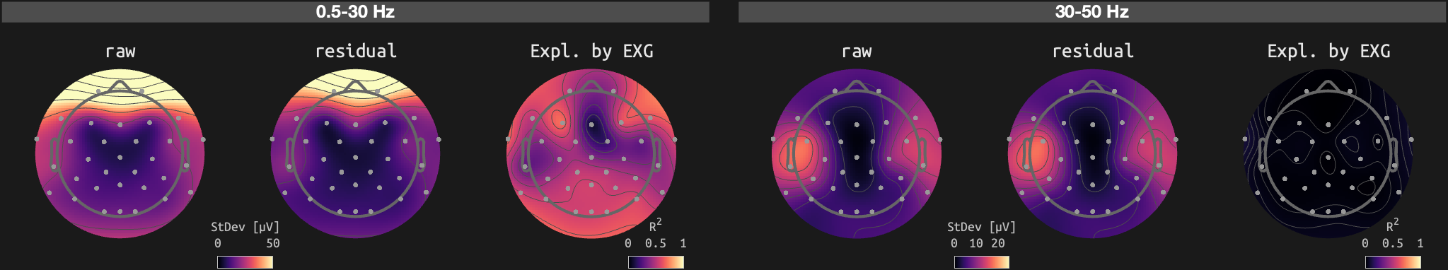 figs/sub-01_ses-15_run-13.png