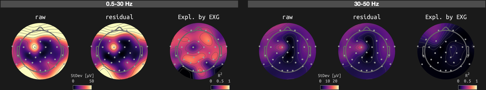 figs/sub-01_ses-16_run-01.png