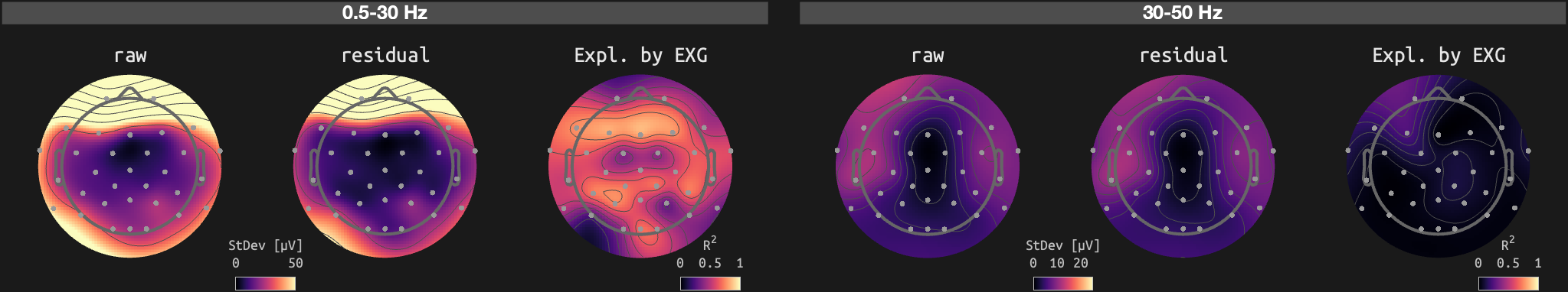 figs/sub-01_ses-16_run-06.png