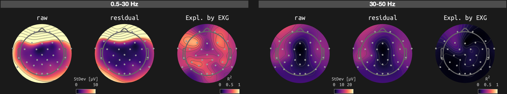figs/sub-01_ses-16_run-10.png