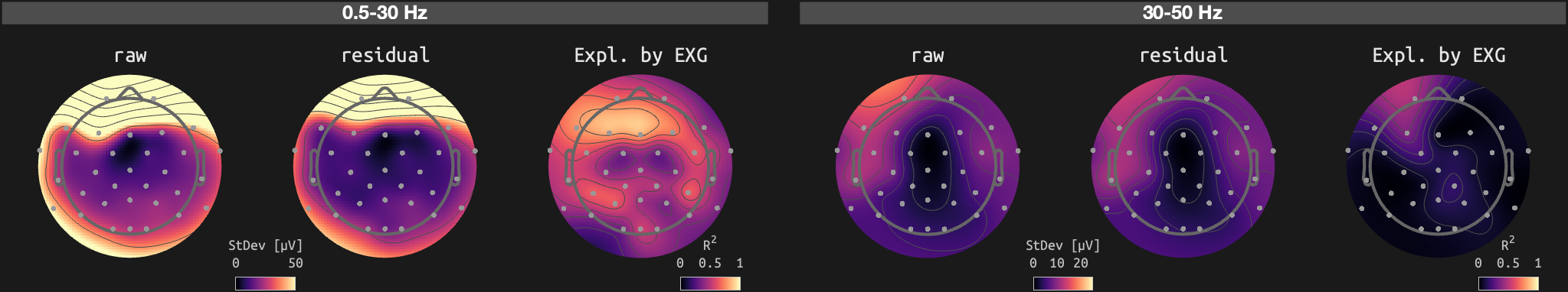 figs/sub-01_ses-16_run-11.png