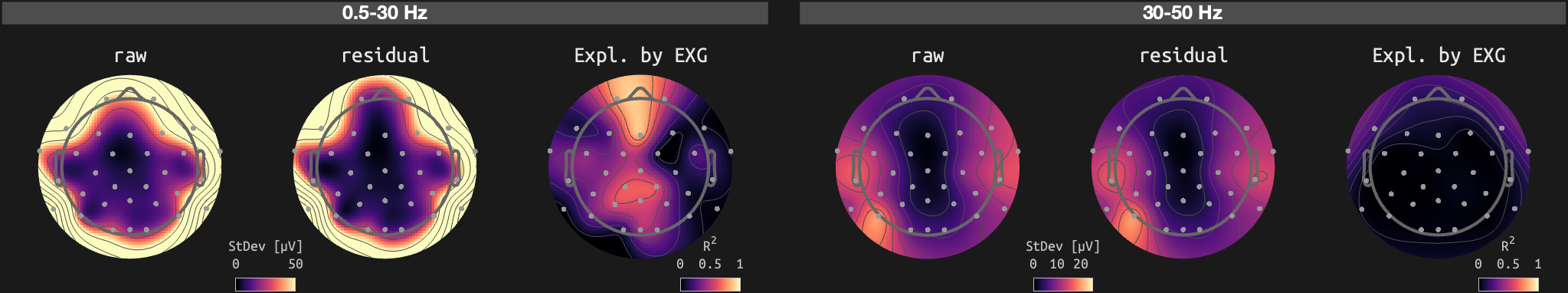 figs/sub-01_ses-17_run-01.png
