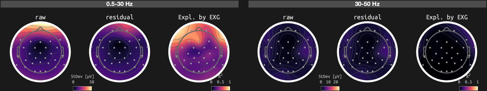 figs/sub-02_ses-15_run-01.png