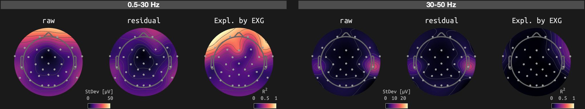 figs/sub-02_ses-15_run-02.png