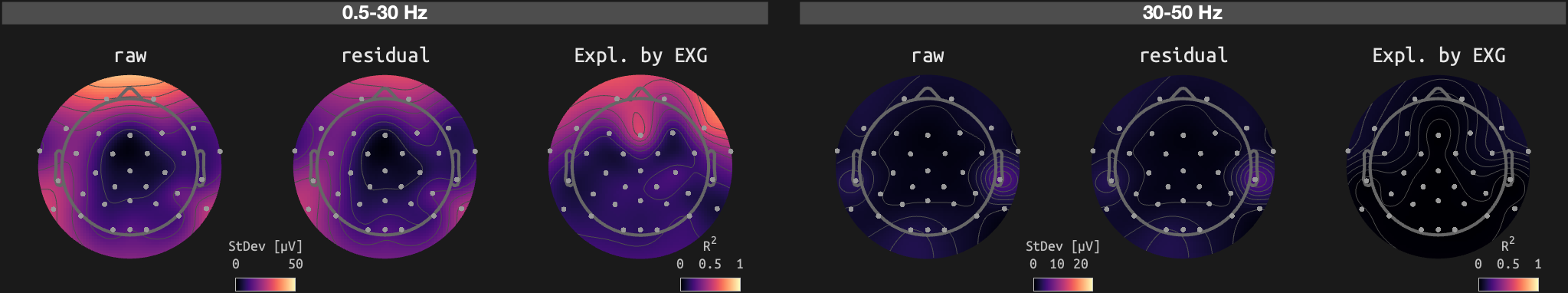figs/sub-02_ses-15_run-04.png