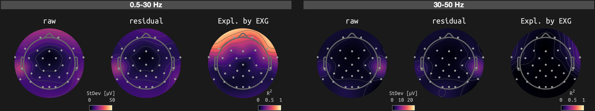 figs/sub-02_ses-15_run-05.png