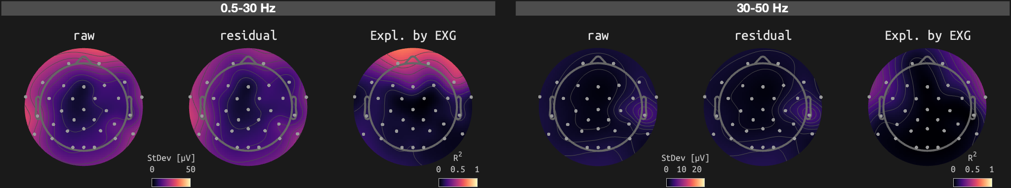 figs/sub-02_ses-15_run-06.png