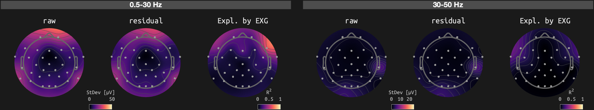 figs/sub-02_ses-15_run-07.png