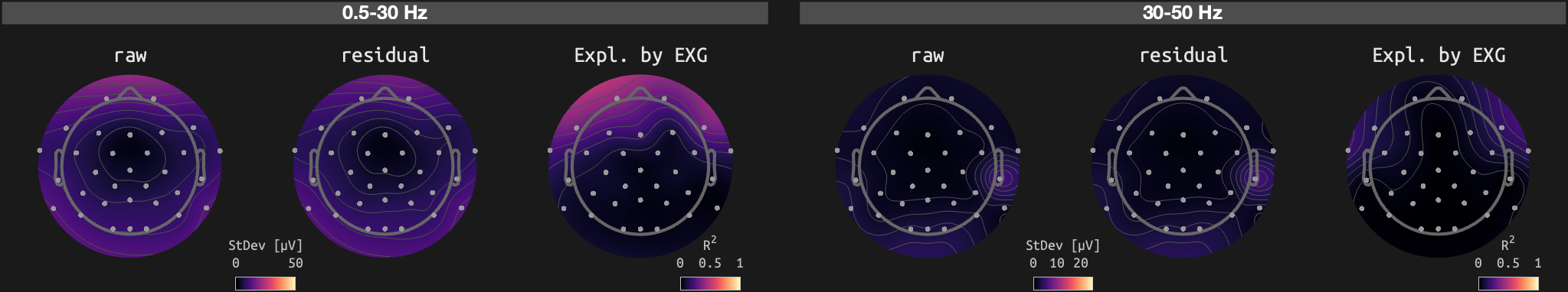 figs/sub-02_ses-15_run-09.png